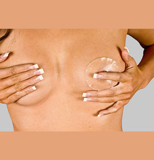 Areola Circles for Breast Scars - Clear (NG-320) - Scarless Canada