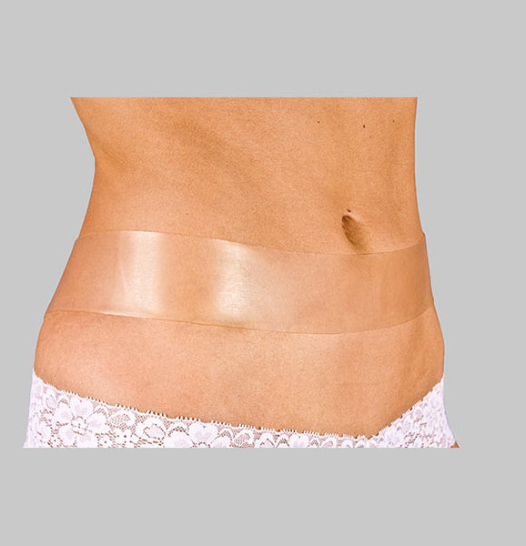 FAILED Muscle Repair? Edousin Scar Strips GIVEAWAY  6 Month Tummy Tuck  Update #plasticsurgery 
